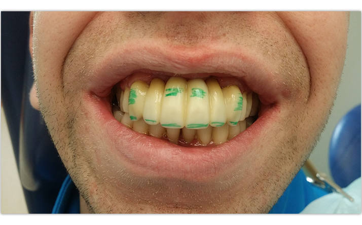 margirey hambalabor waxup