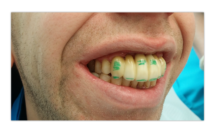 margirey hambalabor waxup