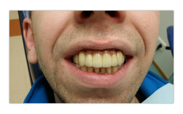 margirey hambalabor waxup