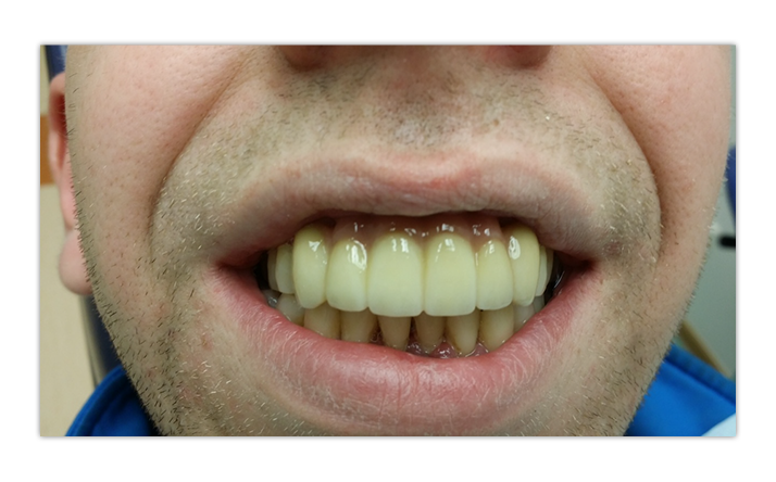 margirey hambalabor waxup